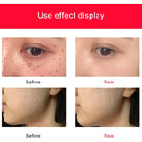 Miniatura del prodotto