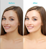 Miniatura del prodotto