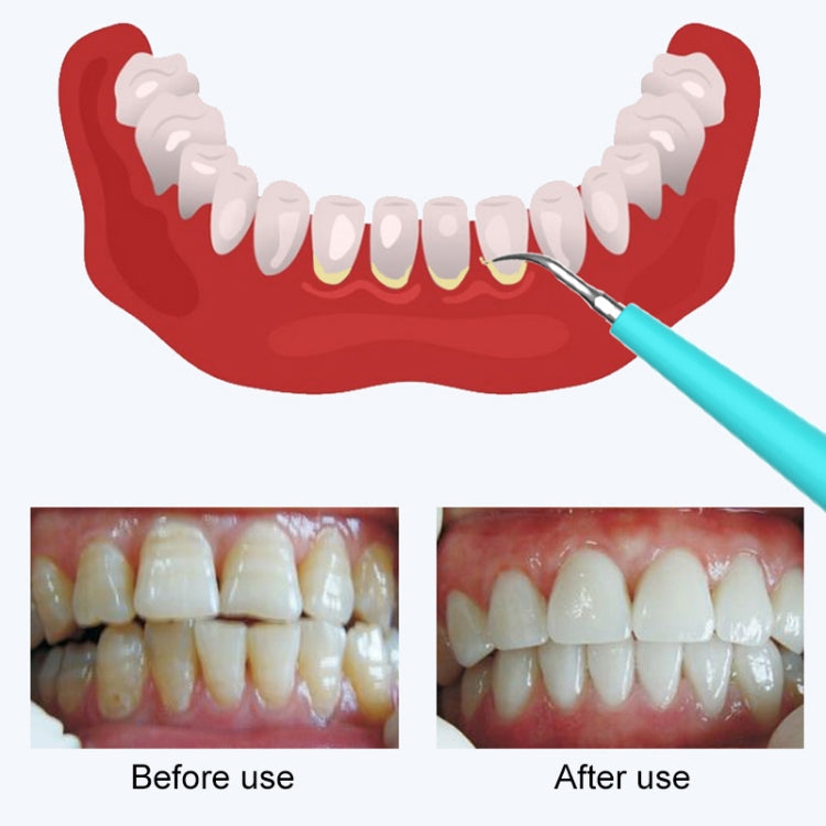 Lucidatore Elettrico per Denti LSHOW YJK015A - Impermeabile,