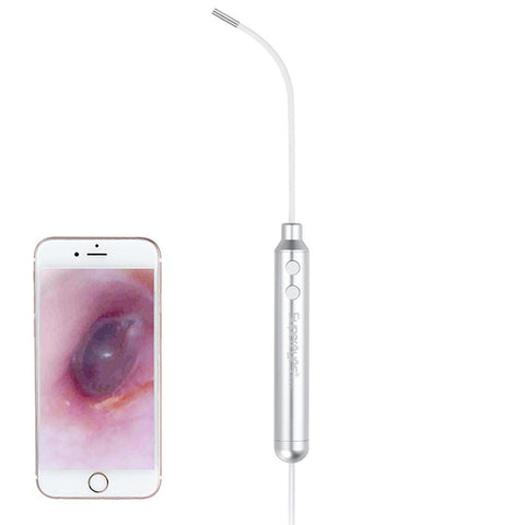 Endoscopio Digitale Supereyes Y001 per Orecchio e Bocca - Fuoco Fisso