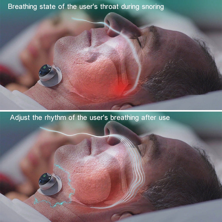 adesivi-per-il-sonno-con-dispositivo-anti-russamento-per-casa - immagine 3