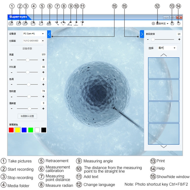 Endoscopio Digitale Wireless Supereyes Y008 per Orecchio, Naso e Bocca